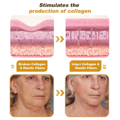 BeeTox™ - Bee Venom Wrinkle Repair Cream 🐝✨ (Buy 1 Get 1 Free 🔥🔥)