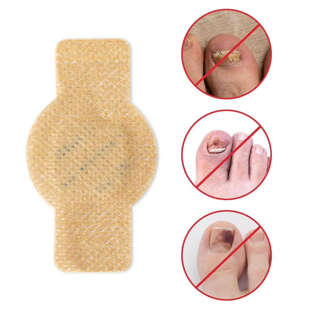 NailHeal Fungal Nail Patches - 7 Day Antifungal Treatment