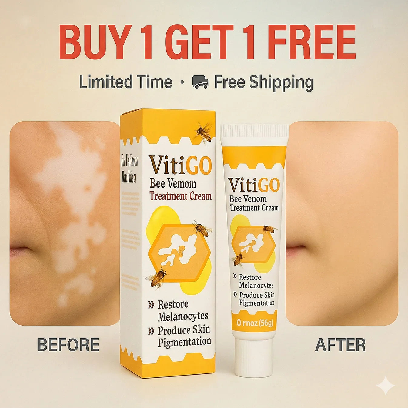 Bee Venom Vitiligo Correcting Cream - Pack of 2